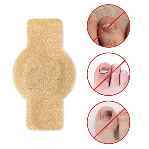 Nail Patches for Toenails & Fingernails – 8-Hour Nail Care Repair Stickers for Extra Strengthening (42pcs)