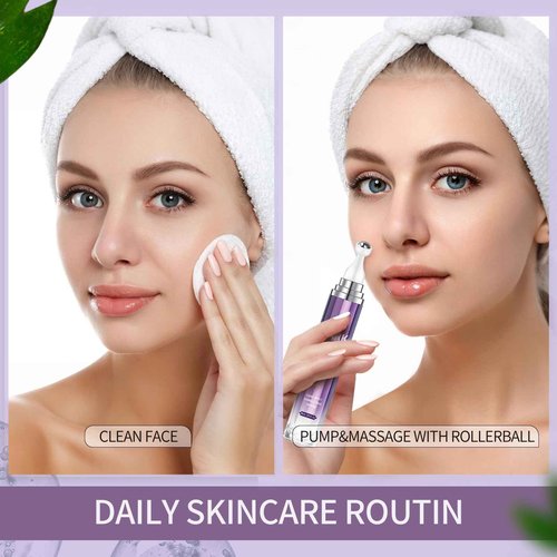 HANYWIL Dark Spot Remover for Face and Body, Dark Spot Corrector Serum, Age Spot Sun Spot Freckles Brown Spot Remover, Melasma Treatment for Face, Skin Care Serum with Roller