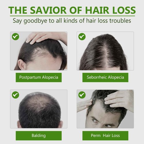 Hair Regrowth System, Hair Growth Serum with Micro Roller & Ginger, Rosemary for Women & Men, Fights Thinning Hair for Thicker Healthier Hair in Several Weeks