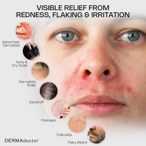 DERMAdoctor Seborrheic Dermatitis Face Wash – 2% Pyrithione Zinc Shampoo Dermatologist Formulated Dandruff Scalp Treatment – Pyrithione Zinc Face Wash and Body Cleanser for Sensitive Skin – 7.10 oz
