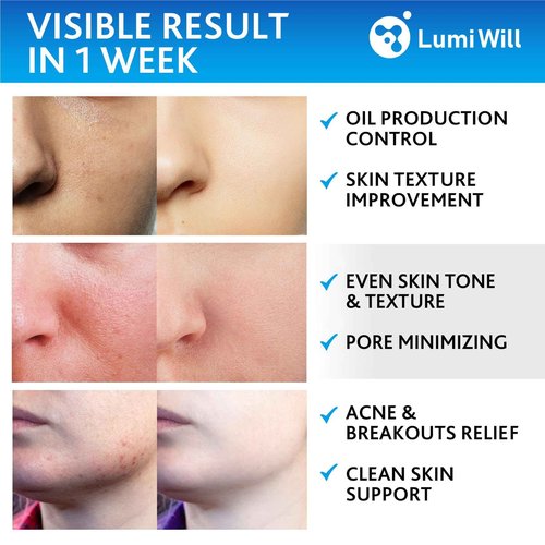 Glycolic Acid Pads - Exfoliating Pads with Glycolic Acid, Vitamins B5, C, E & Menthol - Peel Pads for Acne - Anti-Aging Glycolic Acid Resurfacing Pads for Fine Lines and Wrinkles - 50 Pads