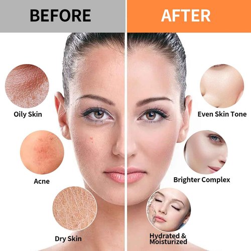 Nielies Vampire & 24K Gold Jelly Mask, Facial Skin Care- Collagen Peel-Off Jelly Mask Set, Jelly Mask For Facials, Hydrojelly Masks,Vegan Peel Off Face Mask, For Brightening & Nourishing