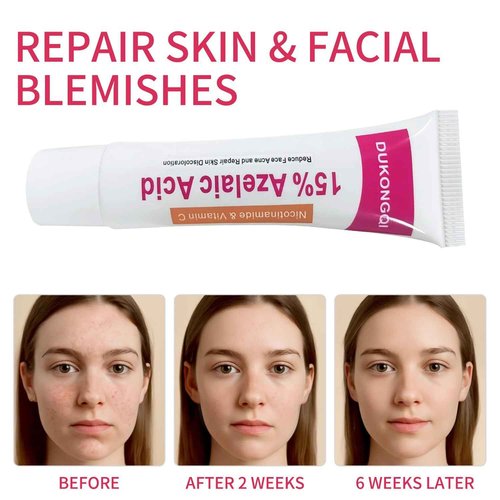 Azelaic Acid Acne Cream: Azelaic Acid For Face - Premium Azelaic Acid Cream - Face Skin and Beauty Care - Azelaic Acid Facial Cream, 20G (2)