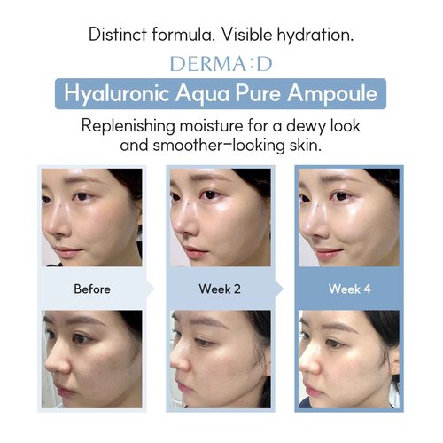 DERMA:D Korean Ampoule with Hyaluronic Acid Serum for Face – Hydrating Formula with Panthenol, Vitamin C & Retinol – Multi-Benefit Skincare Serum to Refresh and Enhance the Look of Skin – 1.69 fl oz
