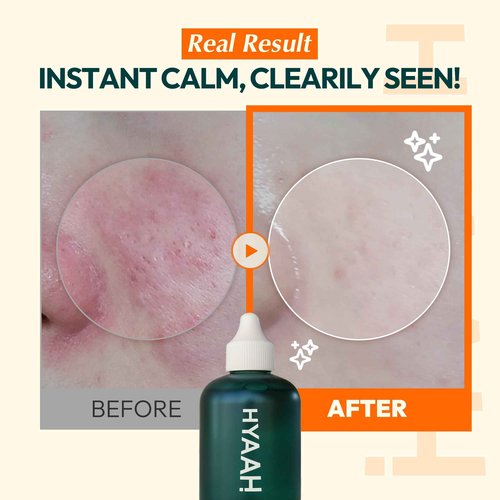 HYAAH Licorice First Essence - Korean Hydrating Toner - Licorice Extract, Hyaluronic Acid and Allantoin - Soothing for Sensitive Skin - Alcohol Free for Sensitive Skin, 6.76 fl.oz