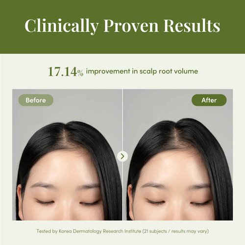 CURLYSHYLL Revitalizing Ampoule | Scalp Serum for Thinning Hair & Sensitive Scalp | Lightweight Daily Use | 50ml
