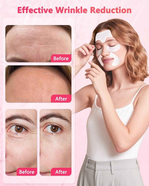 Vryioh 3 IN 1 Forehead, Smile Line & Under Eye Wrinkle Patches, Overnight Facial Wrinkle Treatment with Hyaluronic Acid, Collagen to Lift Lines for Women, 60 Patches