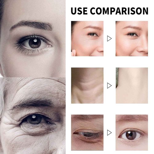 JINMAO Qingling Face Cream, Qingling Wrinkle Removal Cream, Quinglin Polypeptide Tightening and Anti-Wrinkle Moisturizer, Face & Neck & Eye Lotion 3-In-1 (2)