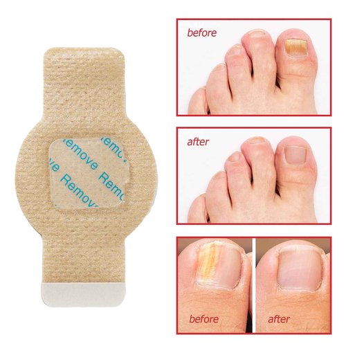 Nail Patches for Toenails & Fingernails – 8-Hour Nail Care Repair Stickers for Extra Strengthening (42pcs)