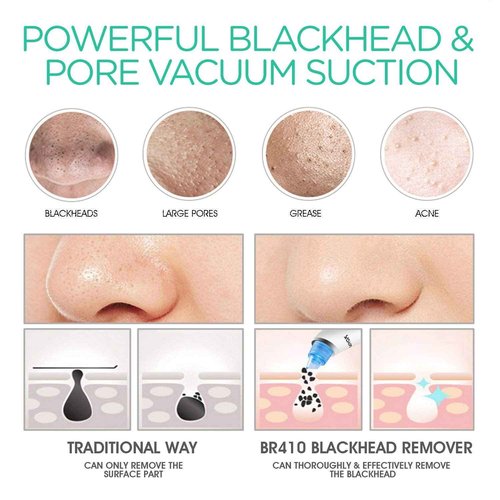 VOYOR Blackhead Remover Pore Vacuum - Facial Cleansing Brush Rechargeable Face Spin Brush for Deep Cleansing