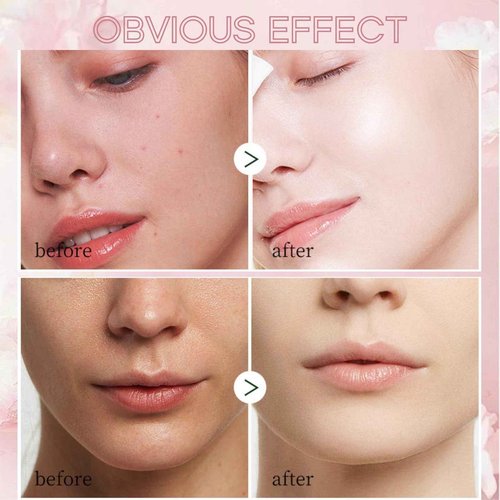 Evolvique Japan Sakura Skincare Set Women Gifts - 8 Pcs Teenage Skin Care Set - Skin Care for Teens 10-12 - Skincare for Girls 10-12 - Teen Skin Care Kit with Face Mask,Cleanser,Cream,Headband