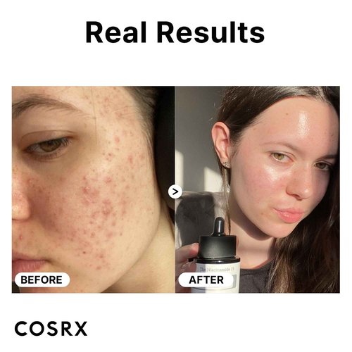 COSRX Morning Skin Care Routine- Daily Essential Galactomyces Balancing Essence & Niacinamide 15% Serum to Improve Rough Skin and Minimize Pores, Korean Skin Care