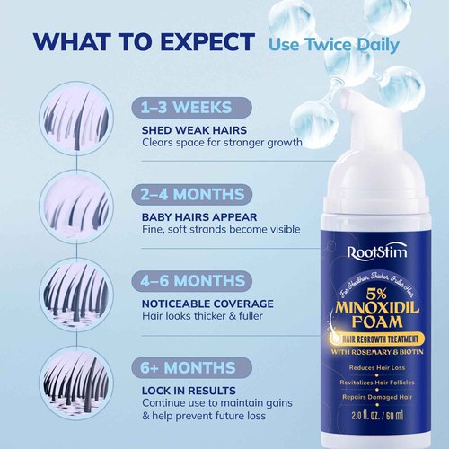 RootStim 5% Minoxidil Foam for men and women, Extra Strength Hair Regrowth Treatment for Thinning Hair and Hair Loss, Hair Follicle Health – Thicker, Fuller Hair Growth Solution 6 FL.OZ