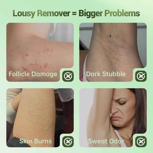 Hair Removal Cream For Women - Painless Body Hair Remover Sensitive Skin Hair Removal For Back Legs Fast And Gentle 6.76 Fl Oz