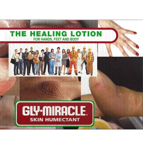 GLY MIRACLE Moisturizing Body Cream, 16 oz Jar - Non-Greasy Skin Humectant for Extremely Dry Skin, Hands, Body, and Feet, Light, Fresh Scent with Pure Glycerin for Nourishing Hydration