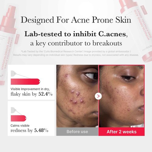 medicube Swipe & Spray Red duo for Troubled Skin: Red Succinic Acid Panthenol Facial Peeling Pads and Power Soothing Spray
