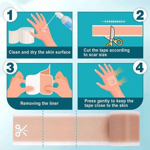 Arme Silicone Scar Tape, 1.6"x480" Silicone Scar Sheets(4 Rolls-12M) Medical Grade Scar Tape for Surgical Scars, Reusable Scar Patches, Professional Scar Removal Strips for C-Section Keloid Tummy Tuck
