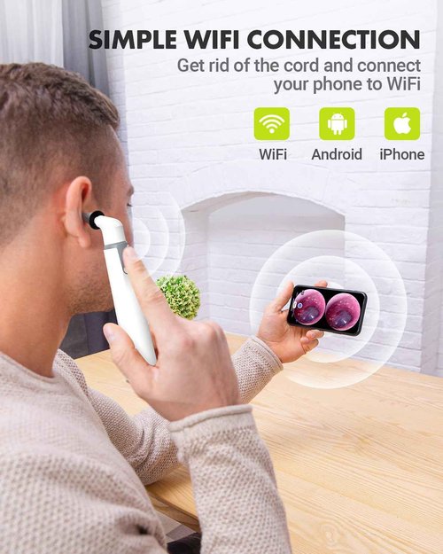 AnyScope Wireless Otoscope with Gyroscope, Ear Camera with Dual View, 3.9 mm Otoscope with Light, Ear Scope with Ear Wax Removal Tool for Kids, Adults, and Pets, Compatible with iPhone and Android