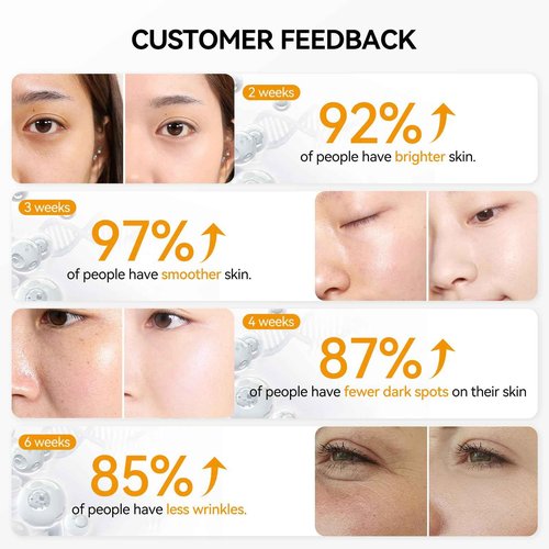 BREYLEE Vitamin C Serum for Face & Eye (1.4 oz) for Brightening Skin,Dark Spot Remover,Reduce Wrinkle,Anti Aging,Moisturizer with Hyaluronic Acid,Vitamin E,Retinol