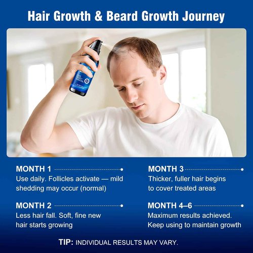 5% Minoxidil Spray for Men and Women,Infused with Biotin, Hair Growth Treatment,Topical hair growth serum,Supports Thicker and Fuller Hair & Beard (6 Pcs,12 Fl Oz Total,6 Month Supply)