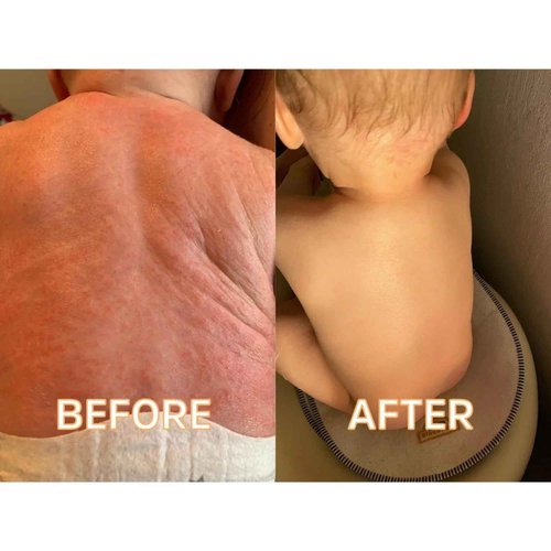 FATCO Baby Butta with Organic Tallow Balm to use as a Safe Pregnancy Moisturizer and Baby Skin Moisturizer - Unscented (4 oz)
