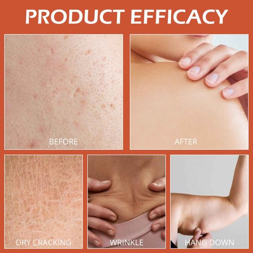 pewatul Body Firming Oil, Ultra Hydrating and Firming Skin for Women Full Body Use | Nourishes Skin, Reduces Fine Lines, Improves Elasticity,100ML (Rose)