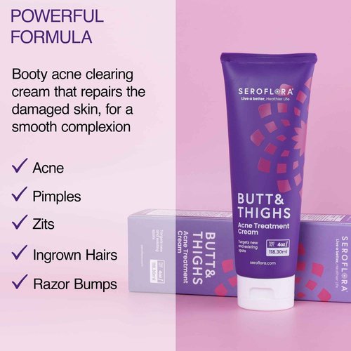 Butt Acne Clearing Treatment Cream - Reduce Bum Acne, Pimples & Zits - Clearing Acne Lotion for Buttocks - 2% Salicylic Acid for Acne Prone Skin (4oz) Made in USA.