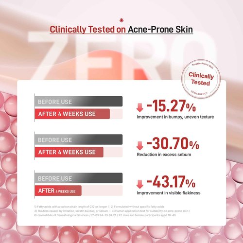 DERMAGENCY Zeroca 81 Korean Calming Cream for Acne-Prone & Sensitive Skin – Lightweight and gentle daily soothing moisturizer, Controls Sebum, Deeply Hydrates & Smooths Texture (2.02 fl.oz. 60 ml)