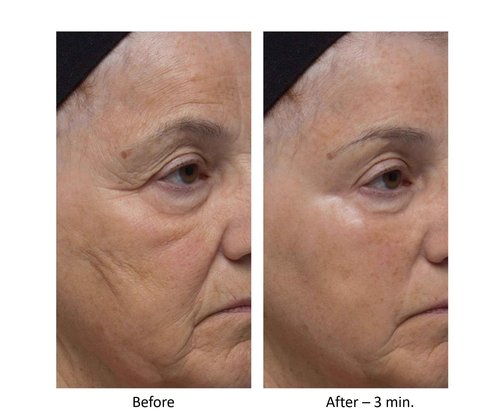 Dr. Denese Wrinkle Lost Line Reducer, 3 Minute Age Eraser With Silk Protein Fiber Technology
