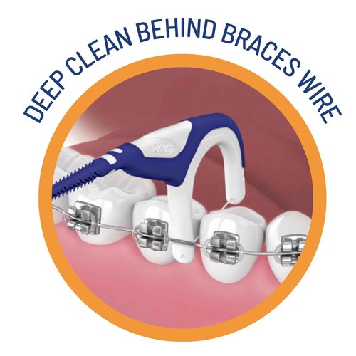 OrVance Braces Flosser - Designed for Braces for an Easy & Effective Clean, Ultra Strong Floss - 40 Count (Pack of 4)