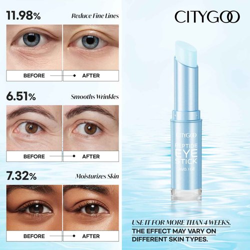 CITYGOO Retinol Eye Stick With Collagen, Hyaluronic Acid For Dark Circle, Under Eye Cream Anti Aging, For Puffiness and Bags Reduces Fine Lines