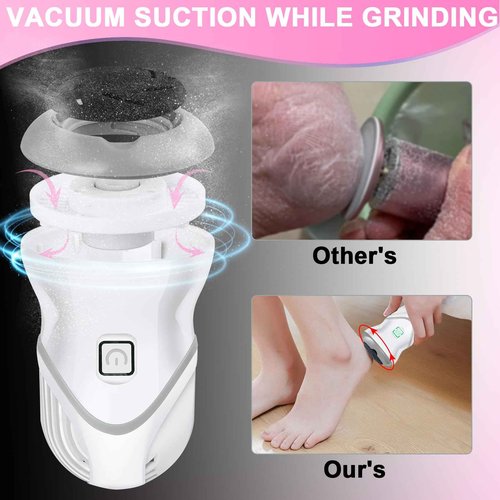 Electric Foot File for Dead Skin Removal, Featuring a Dander Vacuum Foot Scrubber with 2 Speeds and 3 Grinding Heads, Callus Remover Kit for Cracked Skin and Calluses