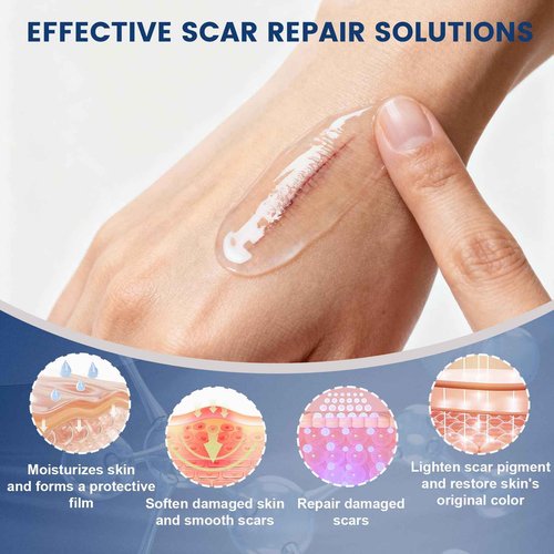 Rvlaim 100% Silicone Scar Gel Scar Cream, Advanced Silicone Gel for Removal of Surgical, Burns, Acne Scar, Old and Recent Scars and Stretch Marks, 1.7 oz/50ml