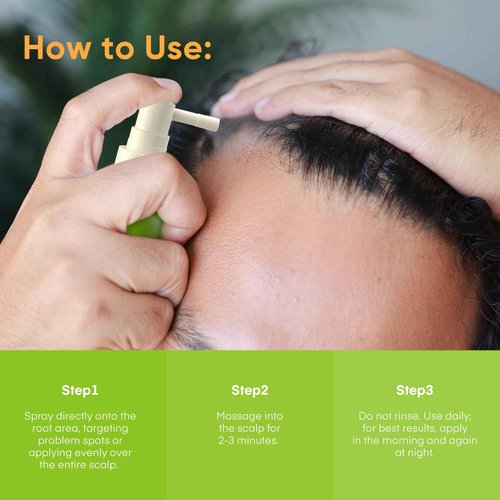 Svvimer Hair Growth Spray Serum - with Rosemary Biotin Batana Oil for Hair Loss and Thinning - Thicker Fuller Longer - for Women and Men 2.7 Fl Oz (Pack of 1)