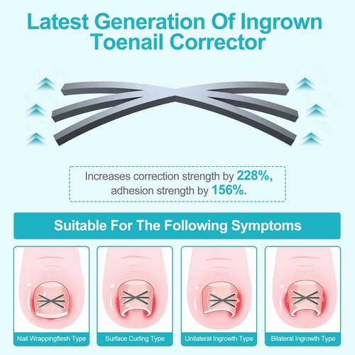Ingrown Toenail Treatment Kit with Upgraded 6-Angle Shape,Titanium Alloy Ingrown Nail Corrector Tools with 4 Multi-Sizes,Ingrown Toe Nail Relief Remover Strips for Curved Toenail Quick Relief,8Pcs