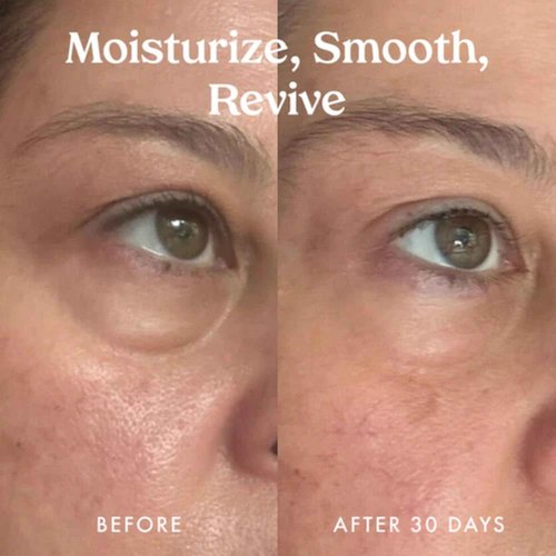 Kopari Ceramide & Retinol Dual-Core Eye Balm – Targets Fine Lines, Texture & Puffiness with Encapsulated Retinol, Ceramides & Squalane – Hydrating, Brightening, Anti-Aging Under Eye Treatment