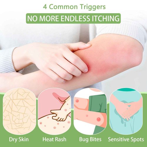 Umex Intensive Itch Relief Cream - Daily Moisturizing Lotion for Sensitive Skin, Soothes Dry & Flaky Skin, Non-Greasy & Fragrance-Free 2PCS(60g/2.12oz)