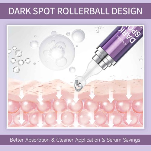 HANYWIL Dark Spot Remover for Face and Body, Dark Spot Corrector Serum, Age Spot Sun Spot Freckles Brown Spot Remover, Melasma Treatment for Face, Skin Care Serum with Roller
