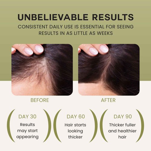 Lebanta Raw Batana Oil for Hair Growth - Cold Pressed Scalp Mask and Wonder Growth Oil Serum, thick and strong natural hair for men & women