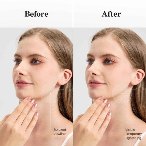 V Line Lifting Mask with Rose Gold - Copper Peptides Jawline Shaper with Collagen and Botanical Blend - Double Chin & Neck Tightening Mask for Face - 7 Pack