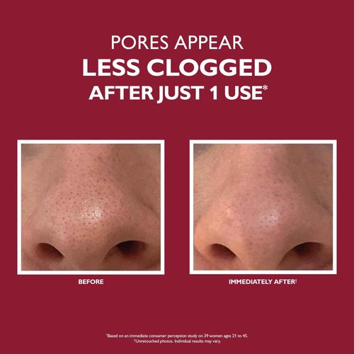 Peter Thomas Roth | Even Smoother™ Microdermabrasion Exfoliating Pore Purifier