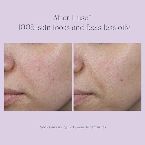 EXUVIANCE Performance Peel AP25 Starter Set, At-Home Chemical Peel, Gently Exfoliates & Refines Pores, Anti-Aging Peel, Treats Fine Lines, Wrinkles & Uneven Texture with Glycolic Acid, 2-week supply