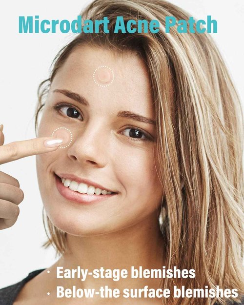 +1HEROLABS Microdart Acne Patch (72 Patches) - Hyaluronate, Salicylic Acid, Vitamin C, Microdart Pimple Patch for Deep, Early Stage and Hidden Pimples (72 Count (Pack of 1))