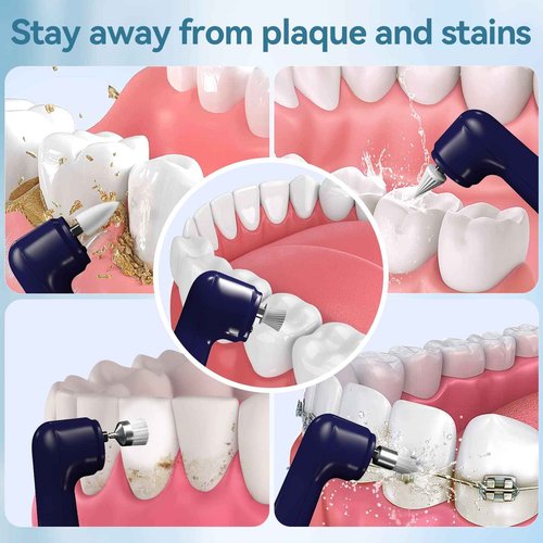 Jeyoe Teeth Polisher and Plaque Remover,Tooth Polishing Kit with 5 Replacement Heads & Cleaning Modes,USB Rechargeable,Ipx6 Waterproof,Teeth Polisher Electric Professional for Adults &Kids