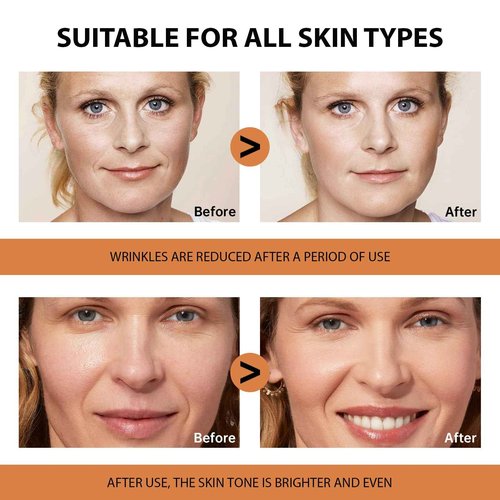 VGO Vitamin C Serum for Face, Vit C Anti Aging Serum with Hyaluronic Acid & Vitamina E, Deep Hydration Facial Care for All Skin Types, 1.01oz / 30ml