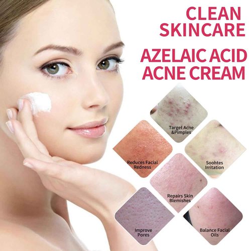 Azelaic Acid Acne Cream: Azelaic Acid For Face - Premium Azelaic Acid Cream - Face Skin and Beauty Care - Azelaic Acid Facial Cream, 20G (2)