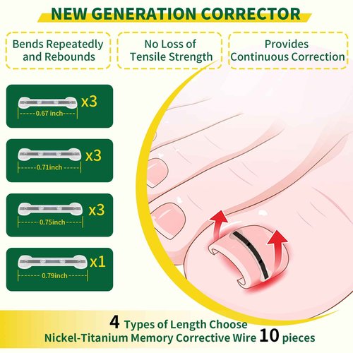 Large Size-Titanium Alloy Ingrown Toenail Treatment & Removal Kit for Quick Relief, Ingrown Toenail Removal Kit， Professional Ingrown Toenail Corrector, Ingrown Toenail Tools for Quick Relief, 10 Pcs