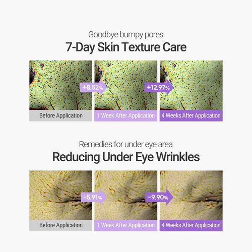 ROVECTIN Retinosine Deep Intense Serum - Retniol 0.15%, Adenosine, Hydrolyzed Collagen, Bakuchiol | For sensitive skin, Korean Skin Care - (0.67 fl oz, 20ml)