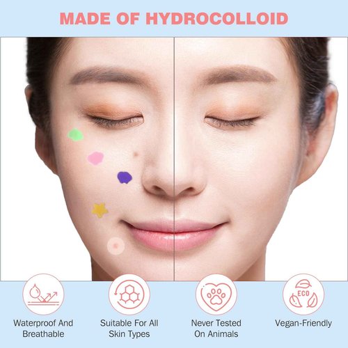 HLOES Pimple Patches for Face 360PCS, Hydrocolloid Acne Patches for Covering Zits and Blemishes, Cute Star Pimple Patches, Facial Skin Care Products.