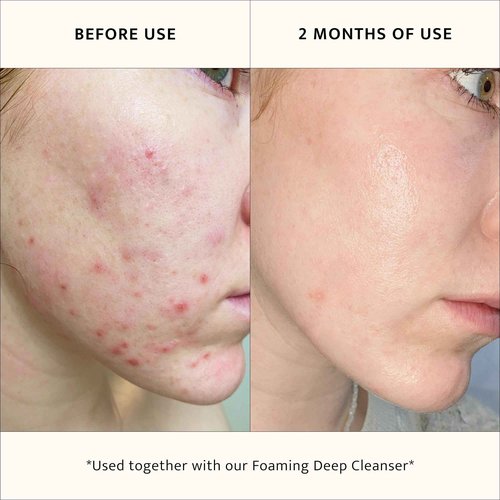 Lemon & Beaker Pore-Reducing Toner - Alcohol-Free, Vegan Face Toner for Soothing & Hydrating Skin, Minimizes Large Pores, 3.5 fl oz, Made in New Zealand